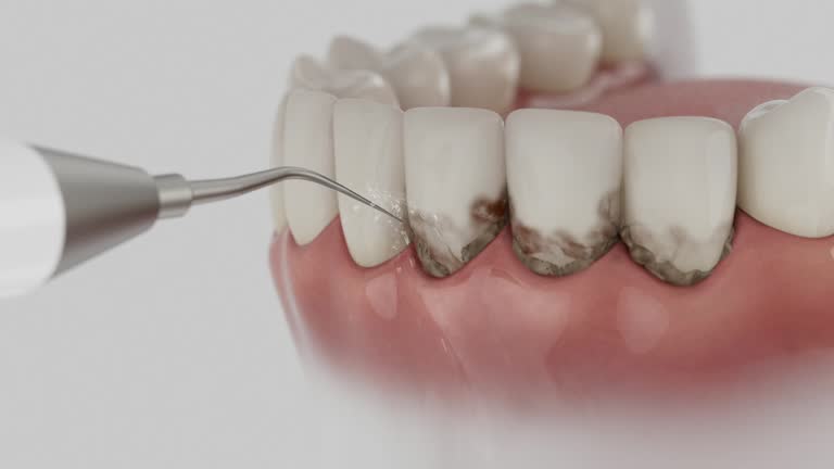 Trusted Wisdom Tooth Removal service in Wewoka, OK - Dentist Open Now